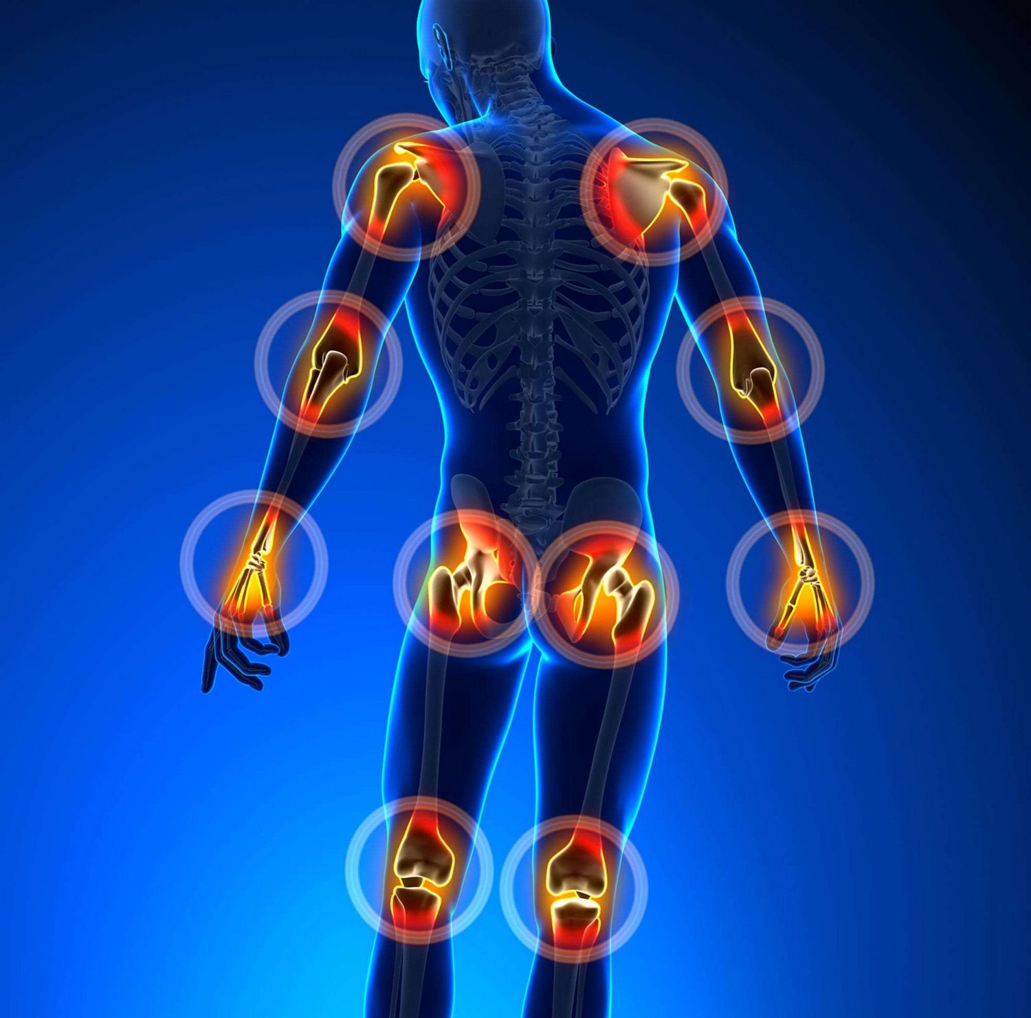 Disconfort articular: motive, semne și terapie